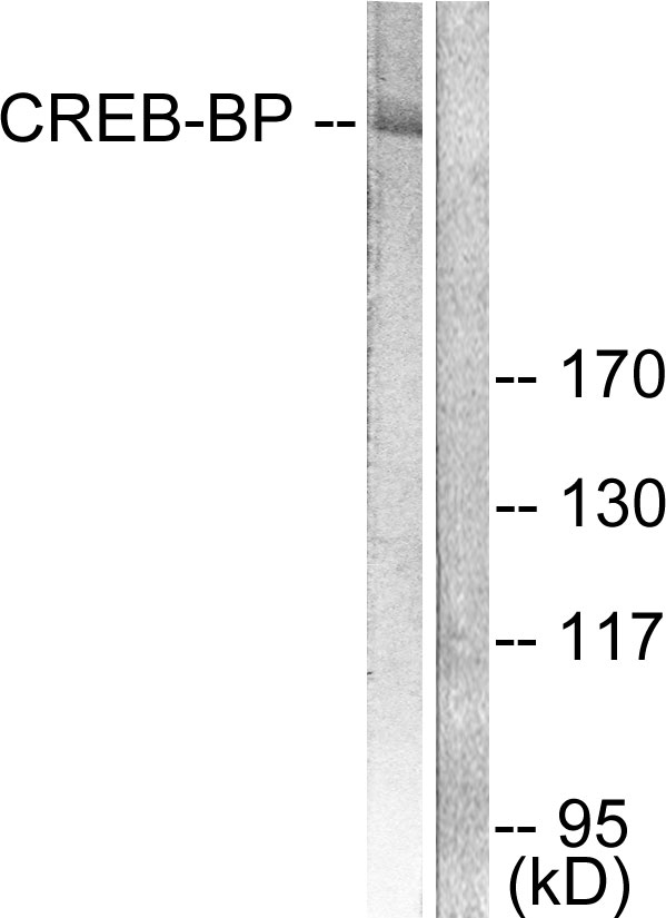 CREBBP / CREB Binding Protein Antibody - Western blot analysis of lysates from HeLa cells, treated with Insulin 0.01U/ml 15', using CREB-BP Antibody. The lane on the right is blocked with the synthesized peptide.