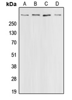 CREBBP / CREB Binding Protein Antibody - Western blot analysis of CBP expression in HeLa (A); A431 (B); HT29 (C); A549 (D) whole cell lysates.