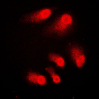 CREBBP / CREB Binding Protein Antibody - Immunofluorescent analysis of CBP staining in A431 cells. Formalin-fixed cells were permeabilized with 0.1% Triton X-100 in TBS for 5-10 minutes and blocked with 3% BSA-PBS for 30 minutes at room temperature. Cells were probed with the primary antibody in 3% BSA-PBS and incubated overnight at 4 C in a humidified chamber. Cells were washed with PBST and incubated with a DyLight 594-conjugated secondary antibody (red) in PBS at room temperature in the dark. DAPI was used to stain the cell nuclei (blue).