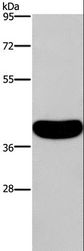 CRELD2 Antibody - Western blot analysis of Human normal colon tissue, using CRELD2 Polyclonal Antibody at dilution of 1:550.