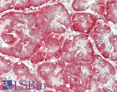 CRELD2 Antibody - Human Pancreas: Formalin-Fixed, Paraffin-Embedded (FFPE)