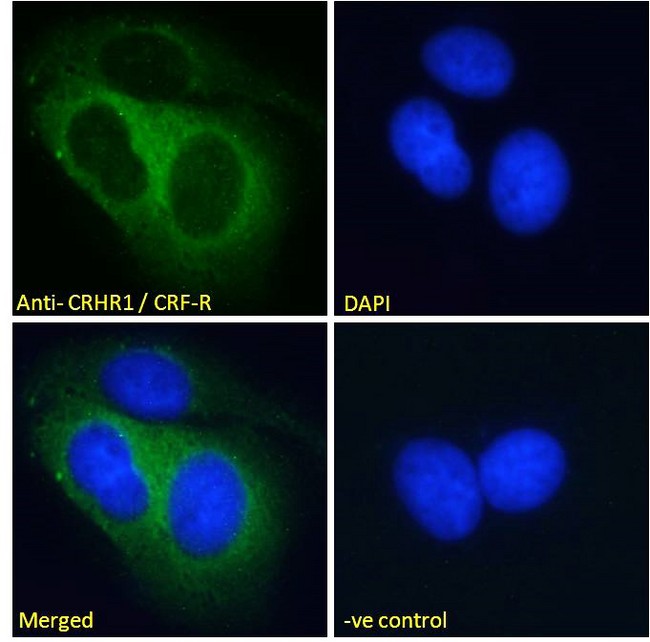 CRFR1 / CRHR1 Antibody - CRFR1 / CRHR1 antibody immunofluorescence analysis of paraformaldehyde fixed MCF7 cells, permeabilized with 0.15% Triton. Primary incubation 1hr (10ug/ml) followed by Alexa Fluor 488 secondary antibody (2ug/ml), showing cytoplasmic and endosome staining. The nuclear stain is DAPI (blue). Negative control: Unimmunized goat IgG (10ug/ml) followed by Alexa Fluor 488 secondary antibody (2ug/ml).