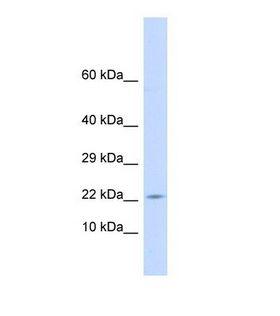 CRH / CRF Antibody - Western blot of Human Placenta. CRH antibody dilution 1.0 ug/ml.  This image was taken for the unconjugated form of this product. Other forms have not been tested.