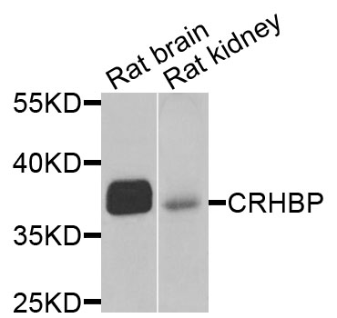 CRHBP Antibody - Western blot analysis of extracts of various cells.