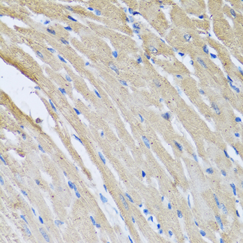 CRHBP Antibody - Immunohistochemistry of paraffin-embedded rat heart, at a dilution of 1:100.