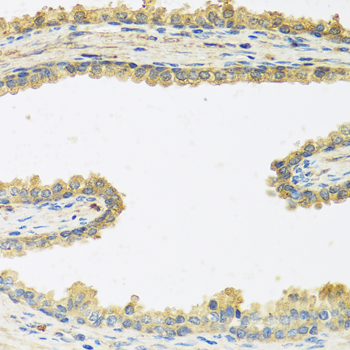 CRHBP Antibody - Immunohistochemistry of paraffin-embedded human prostate, at a dilution of 1:100.