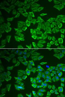 CRHBP Antibody - Immunofluorescence analysis of HeLa cells.