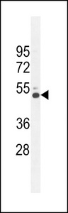 CRHR2 / CRF2 Receptor Antibody - CRFR2 Antibody (D35) western blot of K562 cell line lysates (35 ug/lane). The CRFR2 antibody detected the CRFR2 protein (arrow).