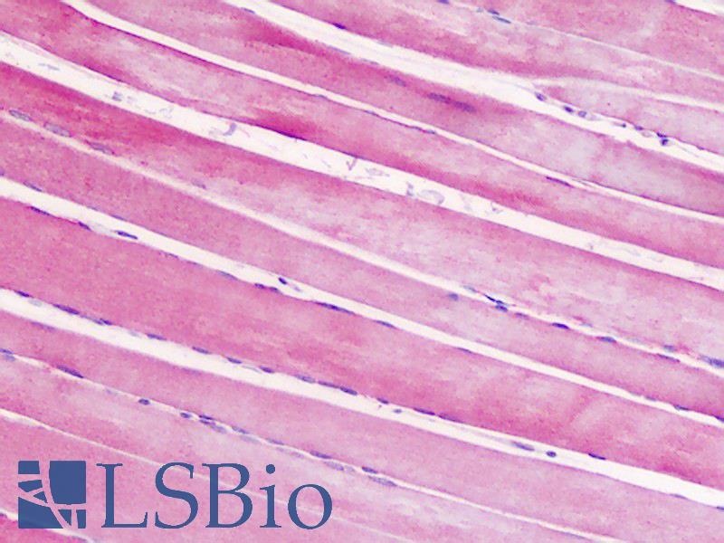 CRHR2 / CRF2 Receptor Antibody - Human, Skeletal muscle: Formalin-Fixed Paraffin-Embedded (FFPE)