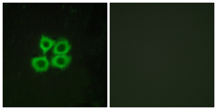 CRHR2 / CRF2 Receptor Antibody - Immunofluorescence analysis of MCF7 cells, using CRHR2 Antibody. The picture on the right is blocked with the synthesized peptide.