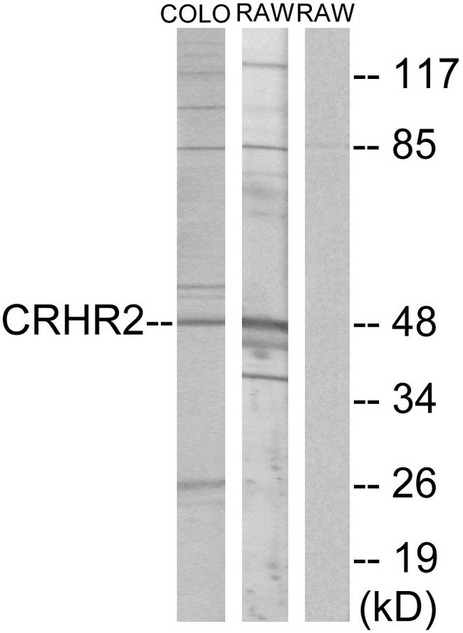 CRHR2 / CRF2 Receptor Antibody - Western blot analysis of lysates from COLO205 and RAW264.7 cells, using CRHR2 Antibody. The lane on the right is blocked with the synthesized peptide.