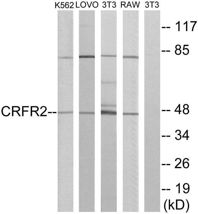 CRHR2 / CRF2 Receptor Antibody - Western blot analysis of lysates from K562, LOVO, NIH/3T3, and RAW264.7 cells, using CRFR2 Antibody. The lane on the right is blocked with the synthesized peptide.