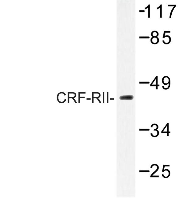 CRHR2 / CRF2 Receptor Antibody - Western blot of CRHR2  (H112) pAb in extracts from K562 cells.