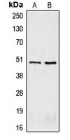CRHR2 / CRF2 Receptor Antibody - Western blot analysis of CRHR2 expression in BC3H1 (A); U87MG (B) whole cell lysates.
