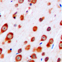 CRHR2 / CRF2 Receptor Antibody - Immunohistochemical analysis of CRHR2 staining in human brain formalin fixed paraffin embedded tissue section. The section was pre-treated using heat mediated antigen retrieval with sodium citrate buffer (pH 6.0). The section was then incubated with the antibody at room temperature and detected using an HRP conjugated compact polymer system. DAB was used as the chromogen. The section was then counterstained with hematoxylin and mounted with DPX.