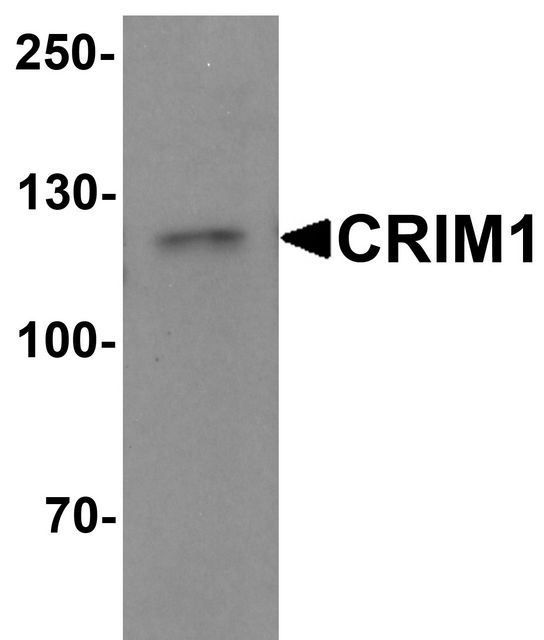 CRIM1 Antibody - Western blot analysis of CRIM1 in Jurkat cell lysate with Crim1 antibody at 1 ug/ml.