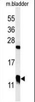 CRIP1 Antibody - Western blot of CRIP1 Antibody in mouse bladder tissue lysates (35 ug/lane). CRIP1 (arrow) was detected using the purified antibody.