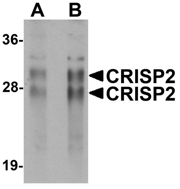 CRISP2 / TSP1 Antibody - Western blot analysis of CRISP2 in human testis tissue lysate with CRISP2 antibody at (A) 0.5 and (B) 1 ug/ml.