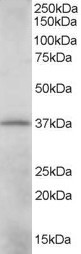 CRKL Antibody - (0.01 ug/ml) Staining of K562 lysate (35 ug protein in RIPA buffer). Primary incubation was 1 hour. Detected by chemiluminescence.