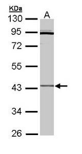 CRLF1 Antibody - Sample (30 ug of whole cell lysate). A: Hep G2 . 10% SDS PAGE. CRLF1 antibody diluted at 1:3000