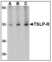 CRLF2 / TSLPR Antibody - Western blot of TSLP Receptor in human liver tissue lysate with CRLF2 / TSLPR Antibody at (A) 0.5, (B) 1 and (C) 2 ug/ml.