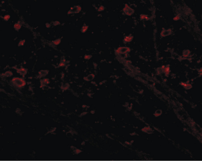 CRMP1 Antibody - Immunofluorescence of CRMP1 in mouse brain tissue with CRMP1 antibody at 5 ug/ml.