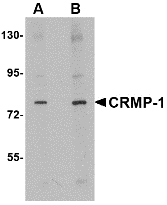 CRMP1 Antibody - Western blot of CRMP1 in rat brain tissue lysate with CRMP1 antibody at (A) 1 and (B) 2 ug/ml.