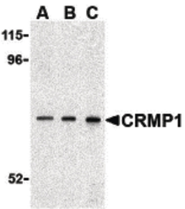 CRMP1 Antibody - Western blot of CRMP1 in 3T3 cell lysate with CRMP1 antibody at (A) 0.5, (B) 1 and (C) 2 ug/ml.