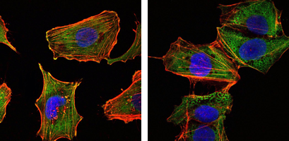 CRTC1 / MECT1 / TORC1 Antibody - Immunofluorescence of U251 (left) and NTERA2 (right) cells using CRTC1 monoclonal antibody (green). Red: Actin filaments have been labeled with DY-554 phalloidin. Blue: DRAQ5 fluorescent DNA dye.