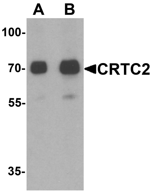 CRTC2 / TORC2 Antibody - Western blot analysis of CRTC2 in human small intestine tissue lysate with CRTC2 antibody at (A) 0.5 and (B) 1 ug/ml.