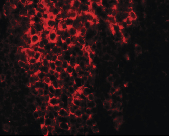 CRTR1 / TFCP2L1 Antibody - Immunofluorescence of TFCP2L1 in rat colon tissue with TFCP2L1 antibody at 20 ug/ml.