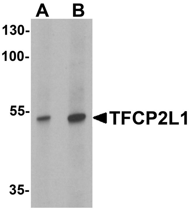 CRTR1 / TFCP2L1 Antibody - Western blot analysis of TFCP2L1 in human colon tissue lysate with TFCP2L1 antibody at (A) 1 and (B) 2 ug/ml