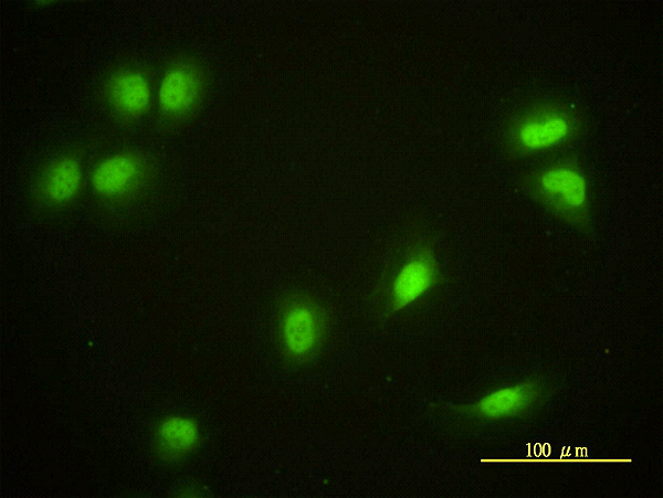 CRY1 Antibody - Immunofluorescence of monoclonal antibody to CRY1 on HeLa cell. [antibody concentration 10 ug/ml]