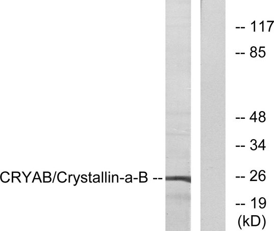CRYAB / Alpha B Crystallin Antibody - Western blot analysis of lysates from 293 cells, using CRYAB Antibody. The lane on the right is blocked with the synthesized peptide.