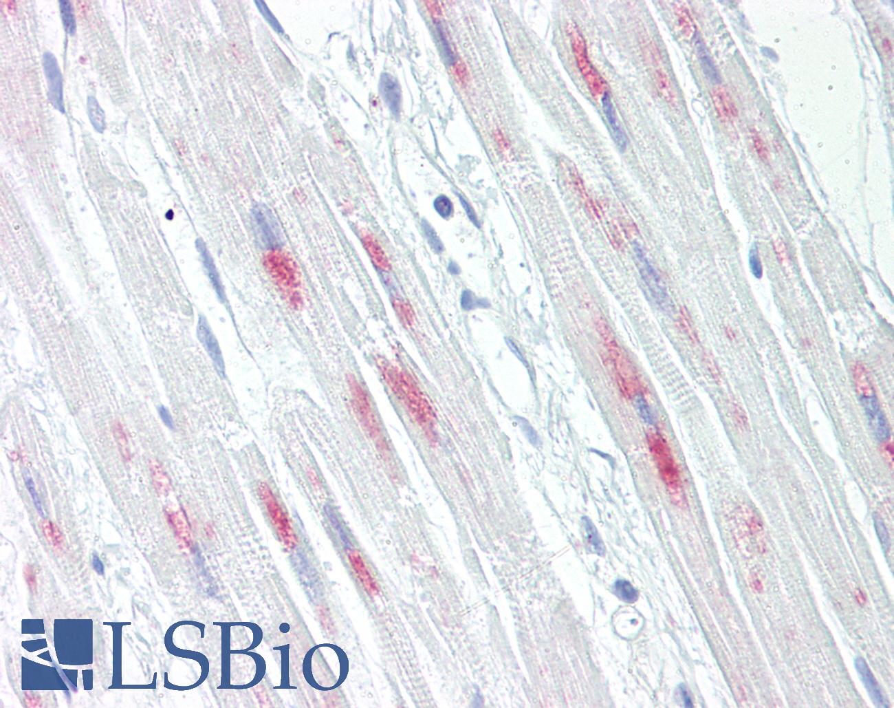 CRYAB / Alpha B Crystallin Antibody - Anti-CRYAB / Alpha B Crystallin antibody IHC of human heart. Immunohistochemistry of formalin-fixed, paraffin-embedded tissue after heat-induced antigen retrieval. Antibody dilution 1:100.