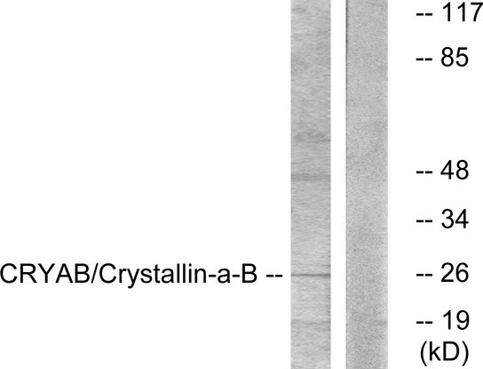 CRYAB / Alpha B Crystallin Antibody - Western blot analysis of lysates from K562 cells, treated with Ca2+ 40nM 30', using CRYAB Antibody. The lane on the right is blocked with the synthesized peptide.