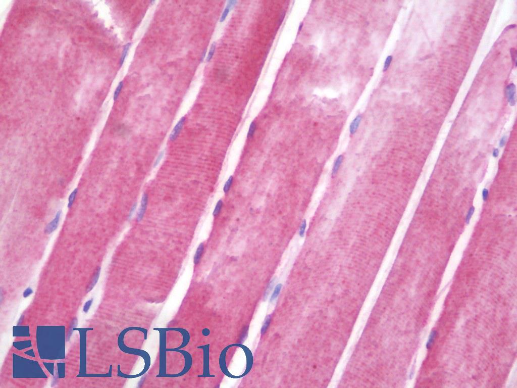 CRYAB / Alpha B Crystallin Antibody - Anti-CRYAB / Alpha B Crystallin antibody IHC staining of human skeletal muscle. Immunohistochemistry of formalin-fixed, paraffin-embedded tissue after heat-induced antigen retrieval. Antibody dilution 1:100.