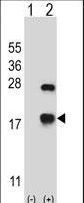 CRYAB / Alpha B Crystallin Antibody - Western blot of CRYAB (arrow) using rabbit polyclonal CRYAB Antibody. 293 cell lysates (2 ug/lane) either nontransfected (Lane 1) or transiently transfected (Lane 2) with the CRYAB gene.