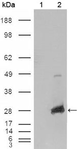 CRYAB / Alpha B Crystallin Antibody - Western blot using CRYAB mouse monoclonal antibody against HEK293T cells transfected with the pCMV6-ENTRY control (1) and pCMV6-ENTRY CRYAB cDNA (2).