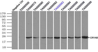 CRYAB / Alpha B Crystallin Antibody - Immunoprecipitation(IP) of CRYAB by using monoclonal anti-CRYAB antibodies (Negative control: IP without adding anti-CRYAB antibody.). For each experiment, 500ul of DDK tagged CRYAB overexpression lysates (at 1:5 dilution with HEK293T lysate), 2 ug of anti-CRYAB antibody and 20ul (0.1 mg) of goat anti-mouse conjugated magnetic beads were mixed and incubated overnight. After extensive wash to remove any non-specific binding, the immuno-precipitated products were analyzed with rabbit anti-DDK polyclonal antibody.