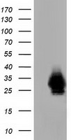 CRYM Antibody - HEK293T cells were transfected with the pCMV6-ENTRY control (Left lane) or pCMV6-ENTRY CRYM (Right lane) cDNA for 48 hrs and lysed. Equivalent amounts of cell lysates (5 ug per lane) were separated by SDS-PAGE and immunoblotted with anti-CRYM.