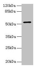 CS / Citrate Synthase Antibody - Western blot All lanes: Citrate synthase, mitochondrial antibody at 3µg/ml+mouse spleen tissue Secondary Goat polyclonal to rabbit at 1/10000 dilution Predicted band size: 52 kDa Observed band size: 52 kDa