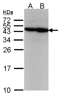 CSA / ERCC8 Antibody - Sample(30 g of whole cell lysate). A:293T. B: A431. 12% SDS PAGE. ERCC8 antibody diluted at 1:500.