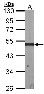 CSA / ERCC8 Antibody - Sample (30 ug of whole cell lysate). A: NIH-3T3. 10% SDS PAGE. ERCC8 antibody diluted at 1:1000.