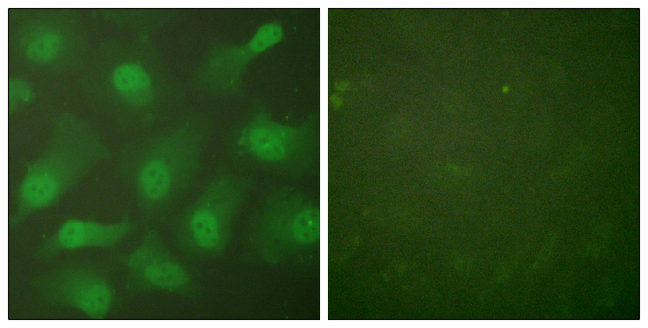 CSE1L Antibody - Immunofluorescence analysis of HeLa cells, using CSE1L Antibody. The picture on the right is blocked with the synthesized peptide.