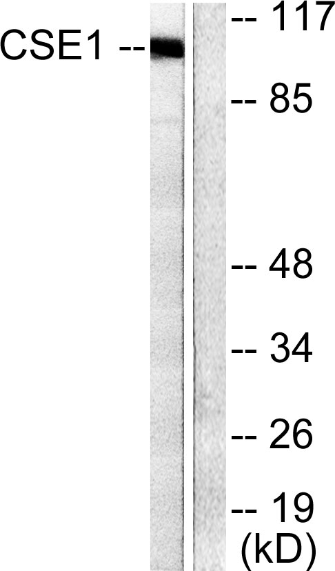 CSE1L Antibody - Western blot analysis of lysates from 293 cells, using CSE1L Antibody. The lane on the right is blocked with the synthesized peptide.