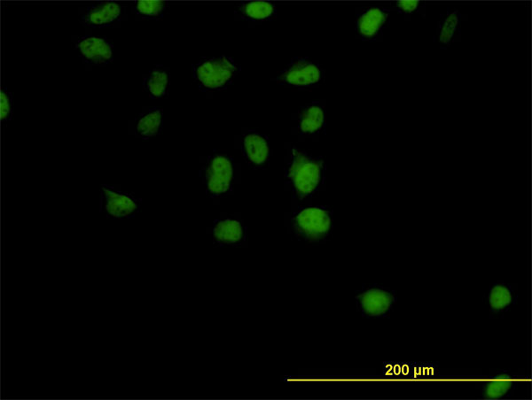CSE1L Antibody - Immunofluorescence of monoclonal antibody to CSE1L on HeLa cell (antibody concentration 10 ug/ml).