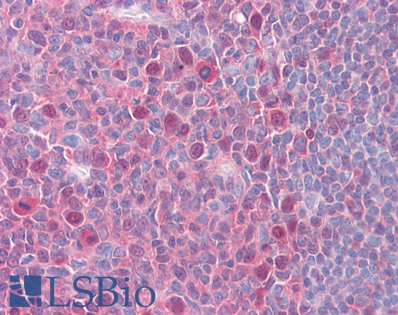 CSE1L Antibody - Anti-CSE1L antibody IHC of human tonsil. Immunohistochemistry of formalin-fixed, paraffin-embedded tissue after heat-induced antigen retrieval. Antibody concentration 5 ug/ml.