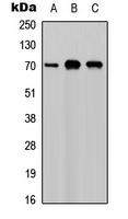 CSF1 / MCSF Antibody - Western blot analysis of M-CSF expression in A549 (A); NS-1 (B); PC12 (C) whole cell lysates.