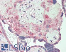 CSF1R / CD115 / FMS Antibody - Human Placenta: Formalin-Fixed, Paraffin-Embedded (FFPE)